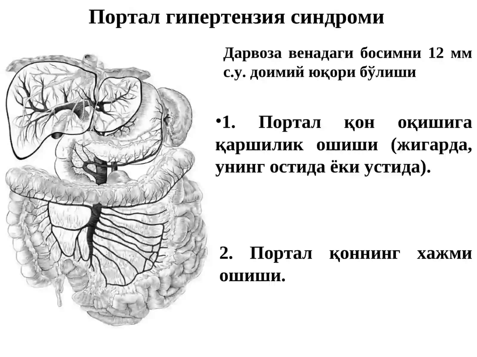 Портал гипертензия 3