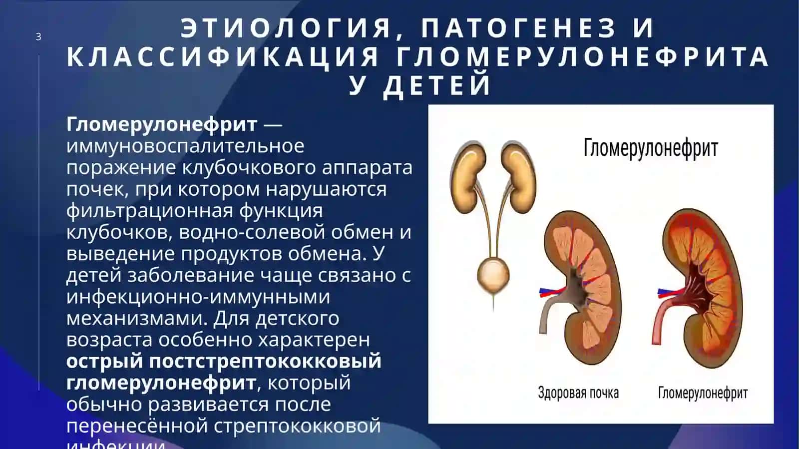 Гломерулонефрит у детей 3