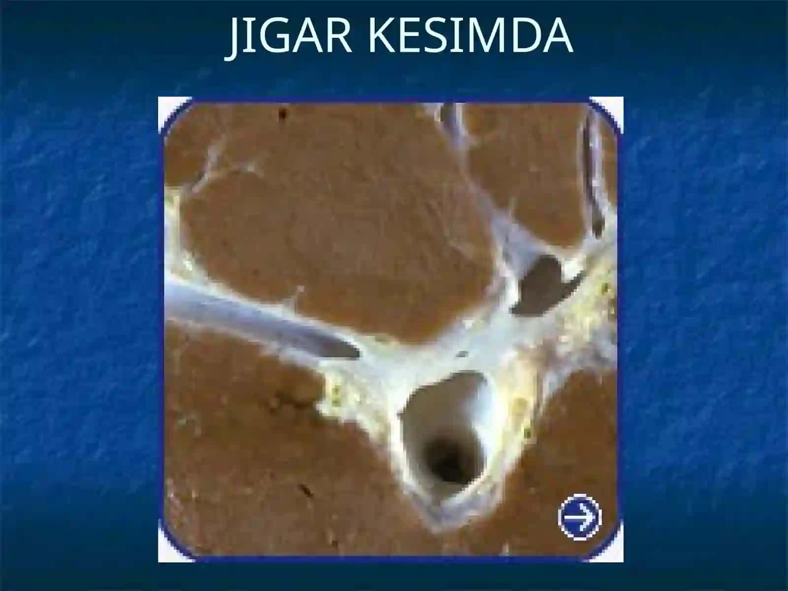 JIGAR SERROZI 3