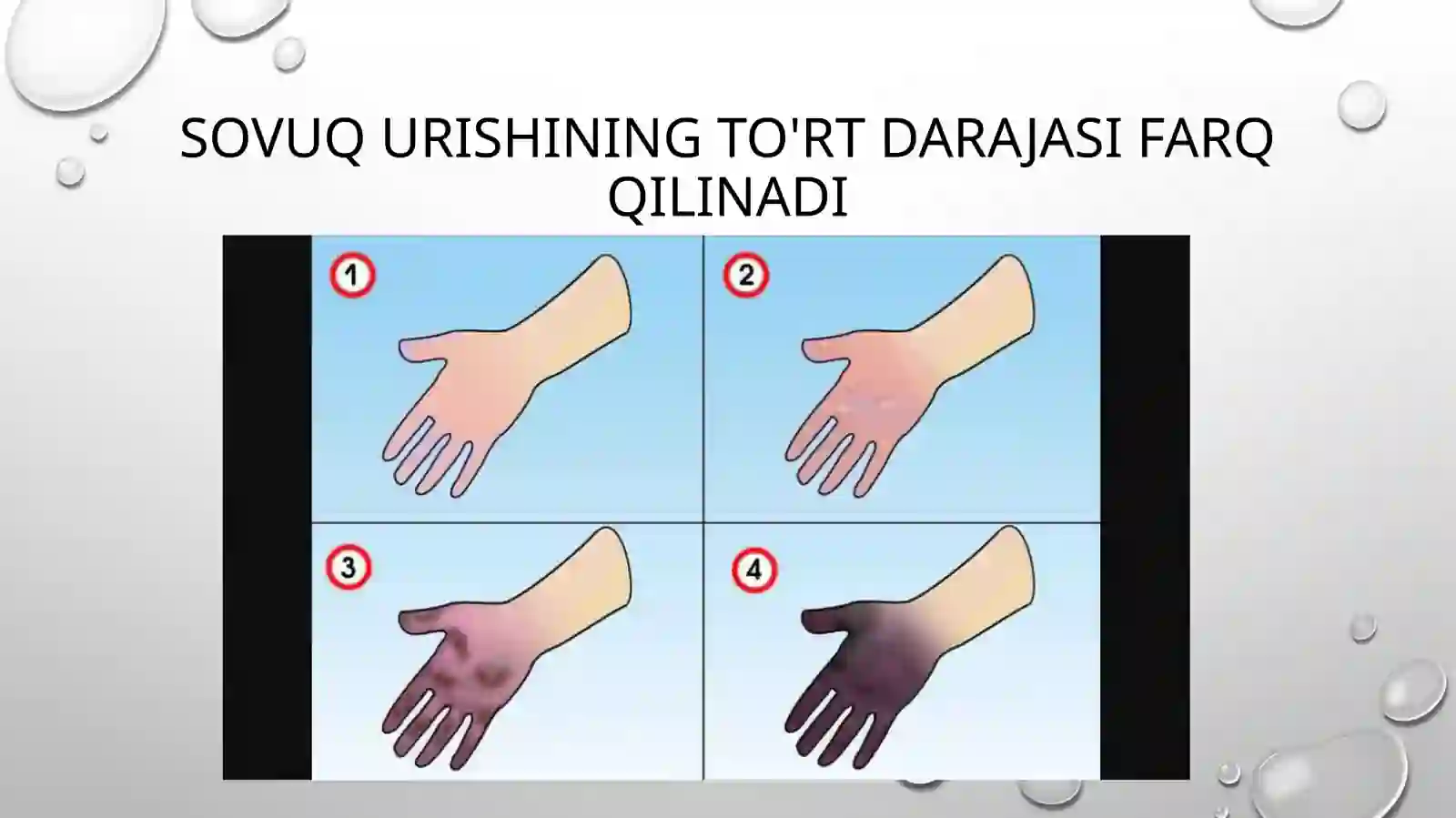 Sovuq urishi 3
