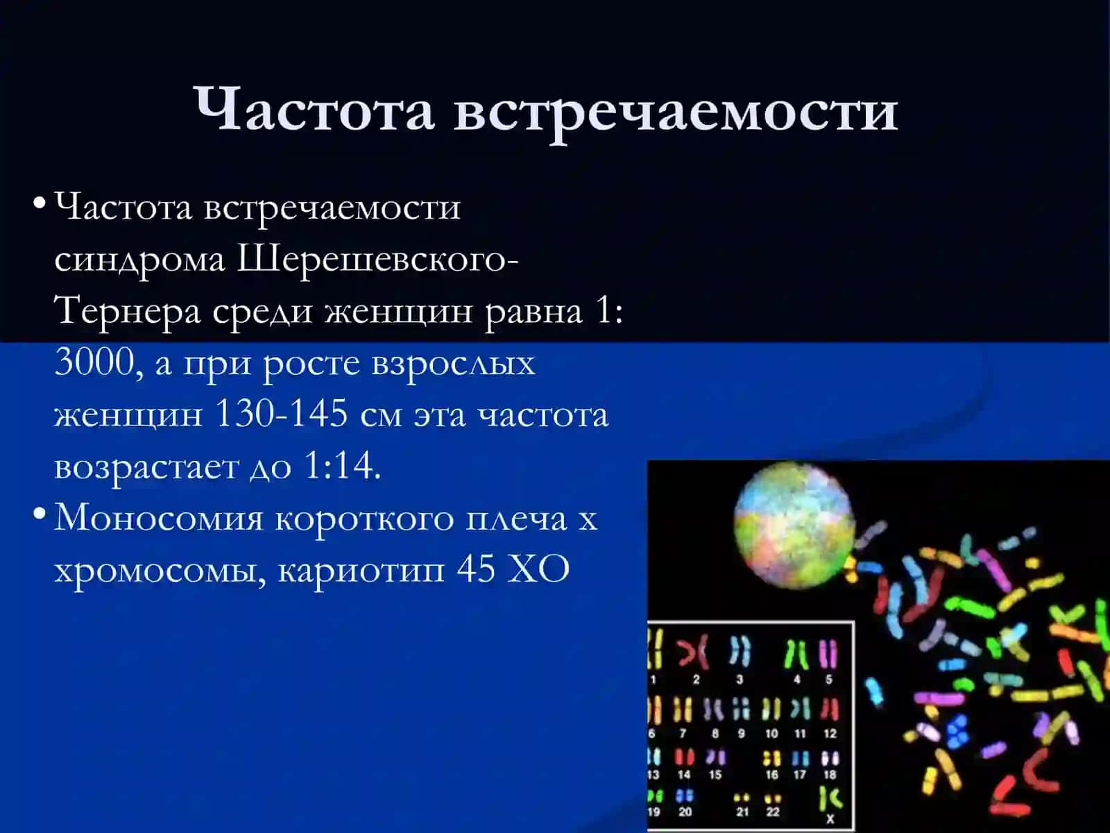 Синдром Шерешевского - Тернера 3