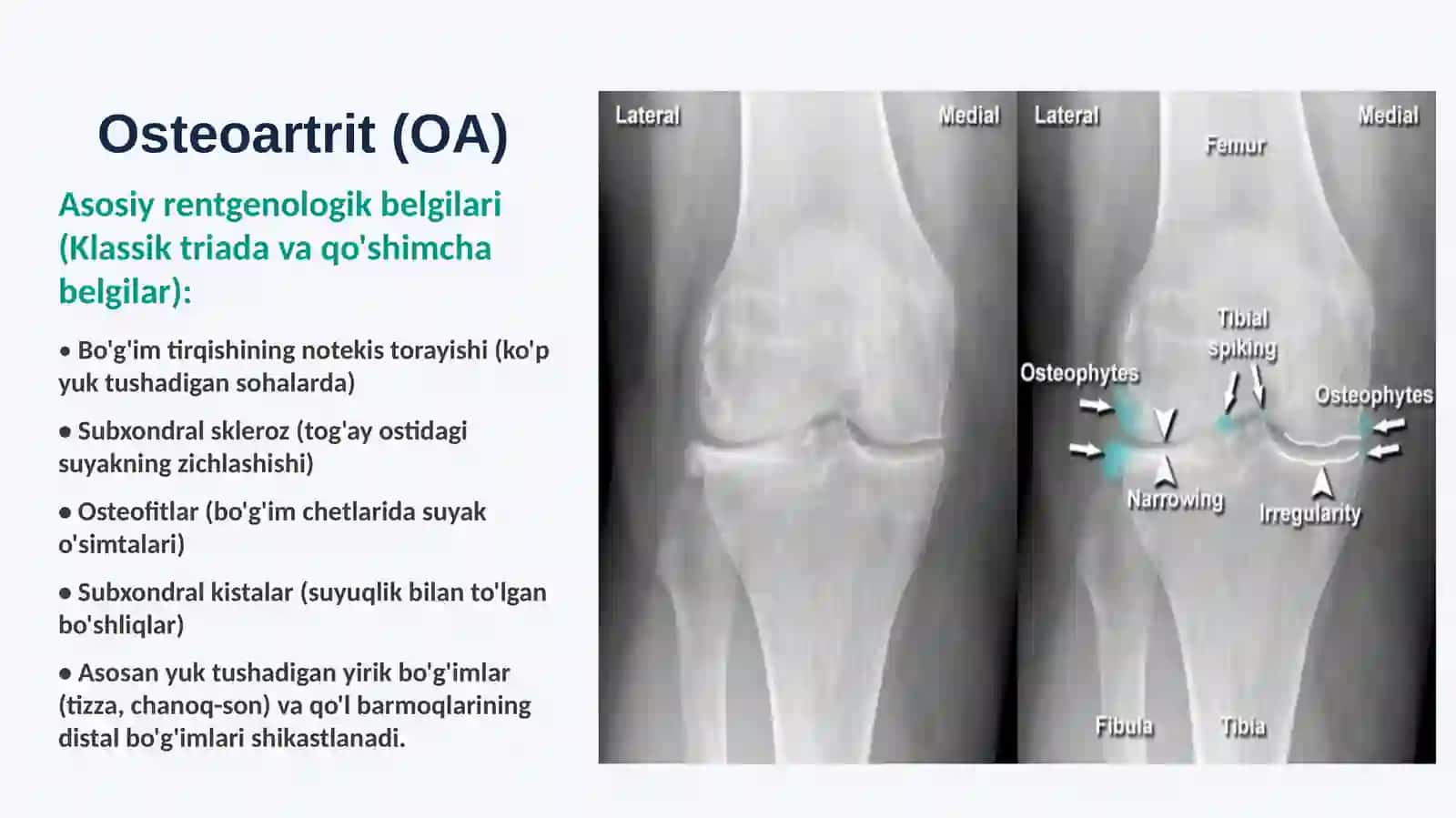 Radiologiya:Artritlar 3