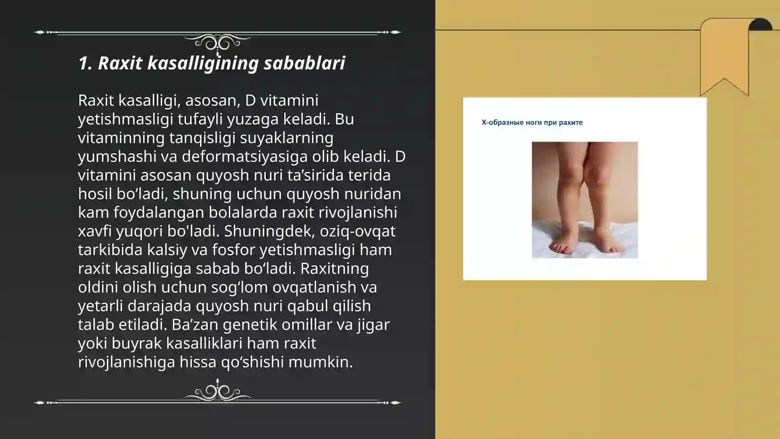 Raxit kasalligi 3