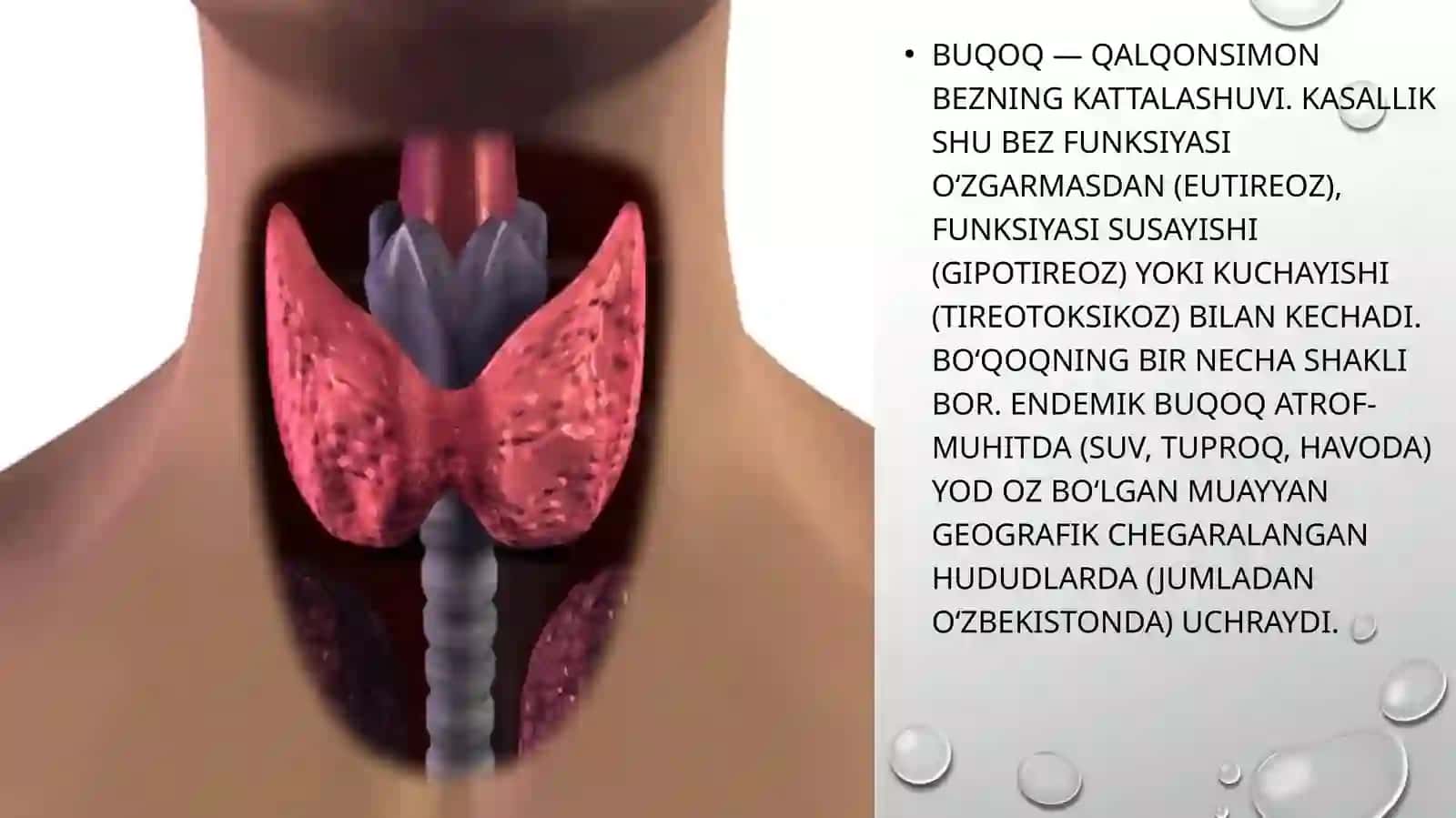 Endemik Buqoq Kasalligi 3