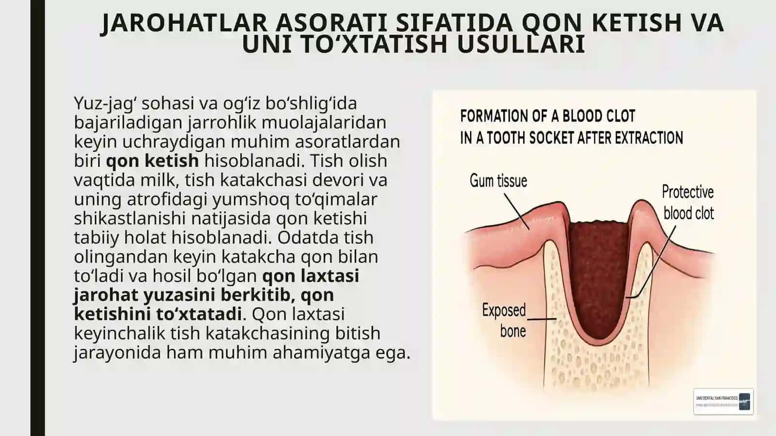 Jarohatlar asoratida qon ketishi 3