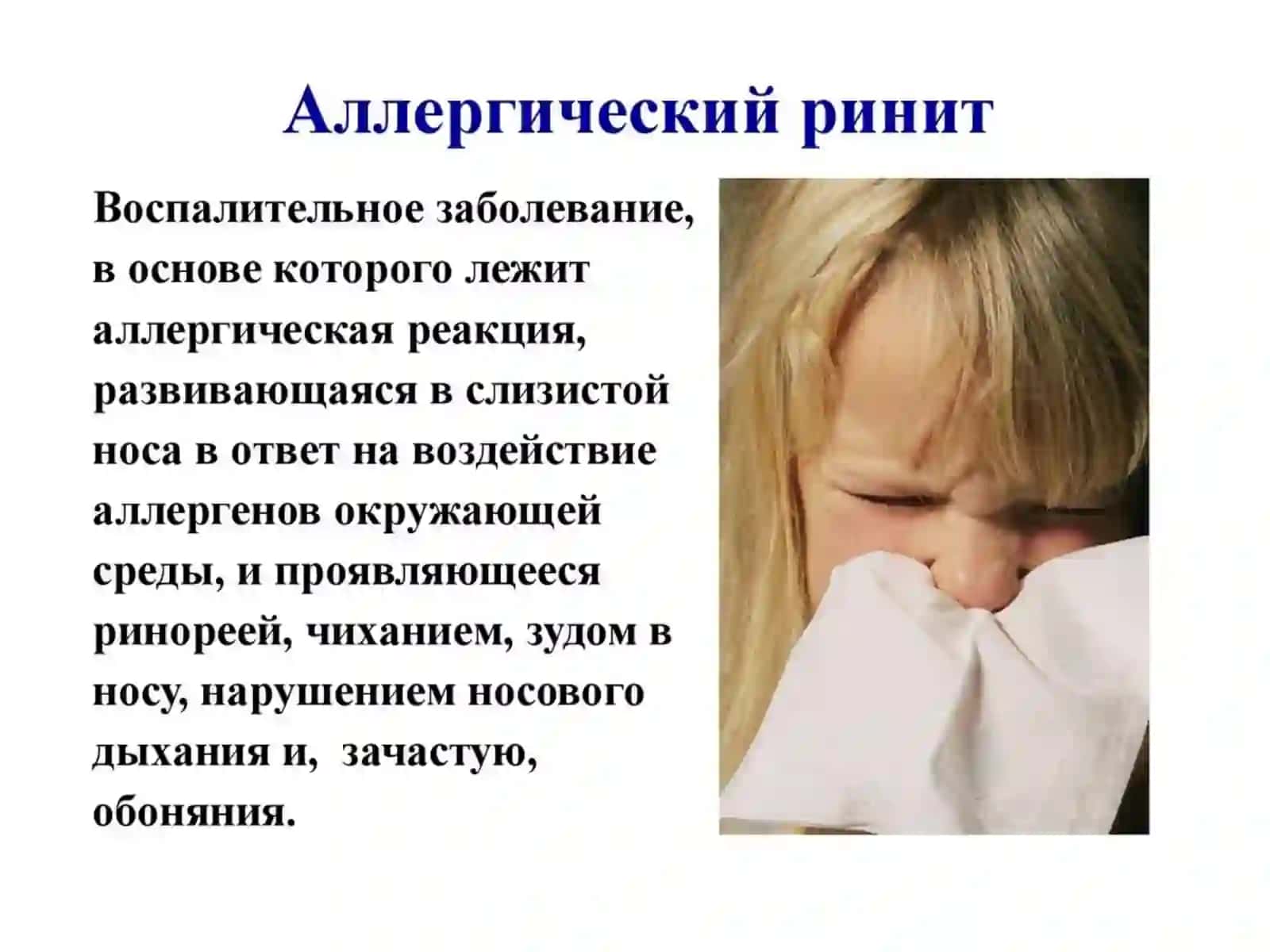 Аллергический ринит 3