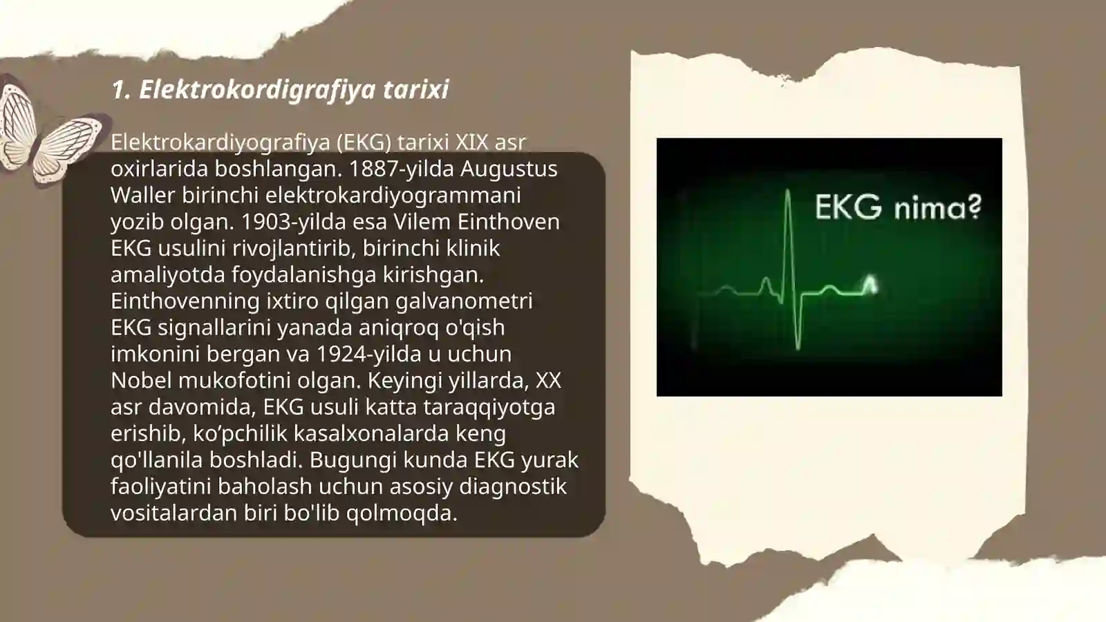Elektrokordigrafiya 3