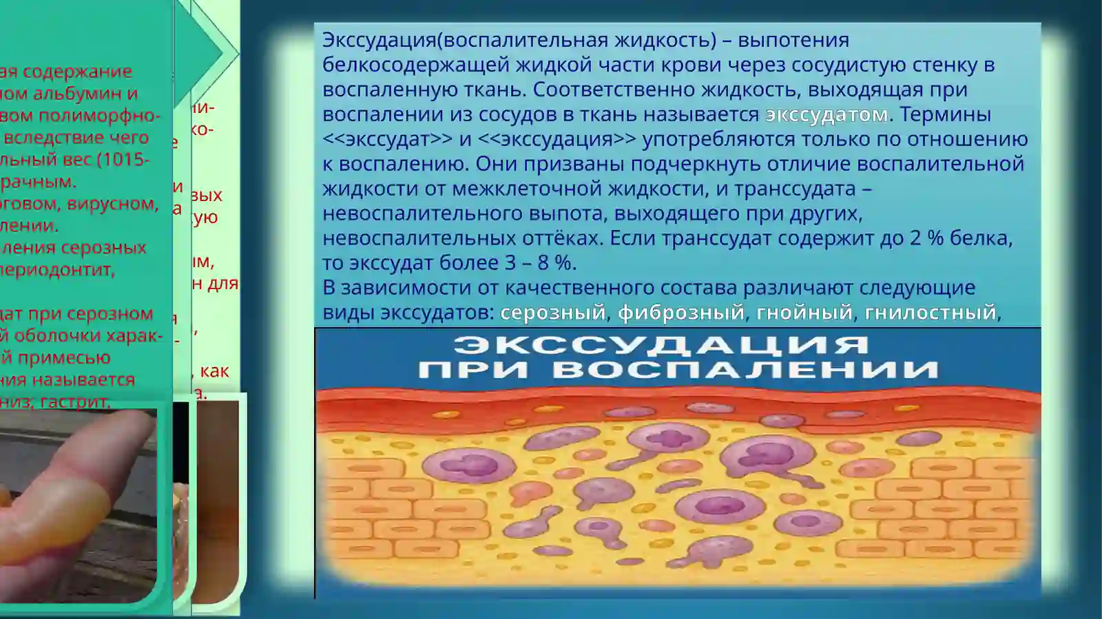 ПАТОФИЗИОЛОГИЯ 3