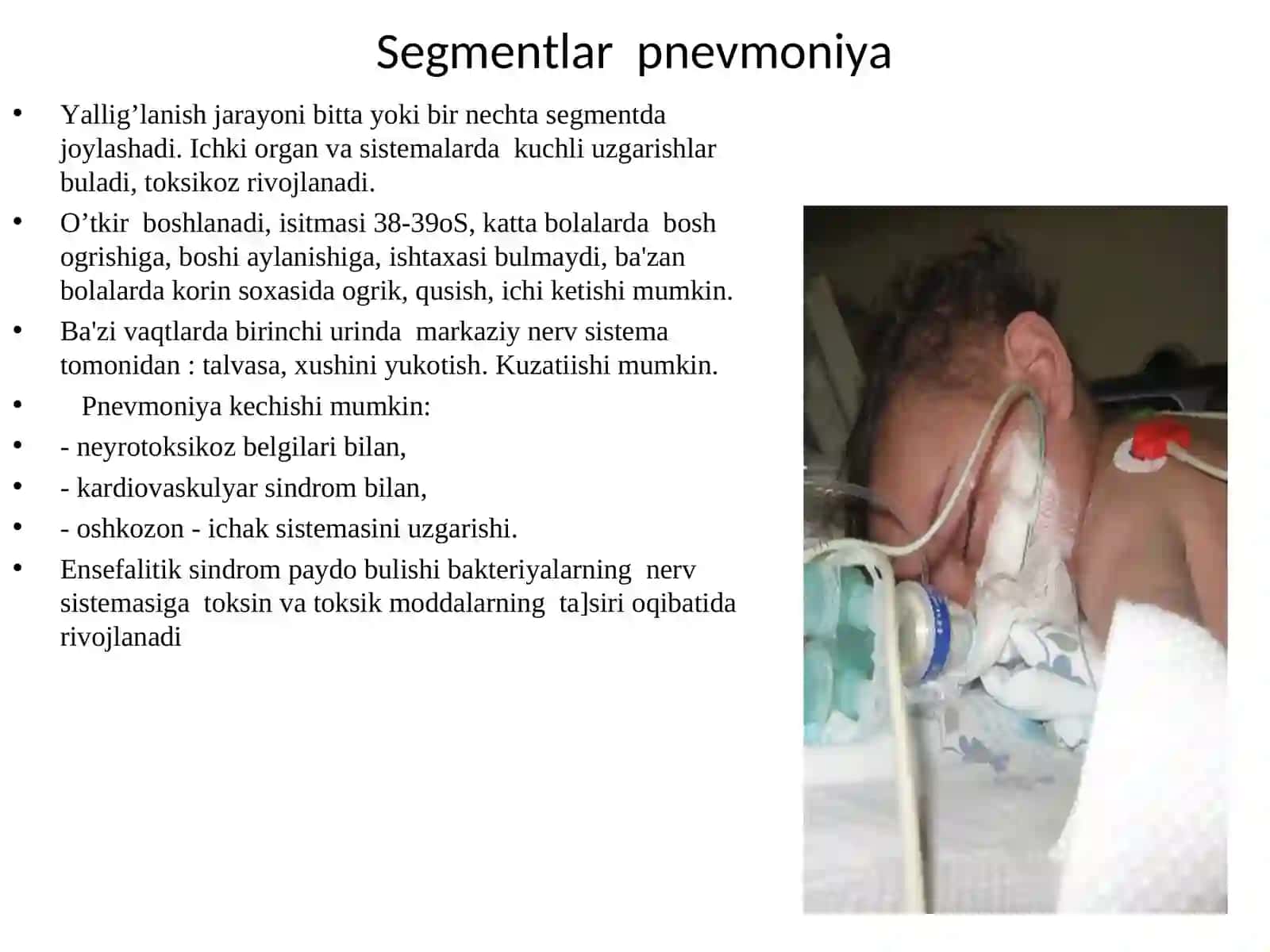 Pediatriya fakultetiBolalarda pnevmoniyakasalligi Ma'ruza rejasi 3