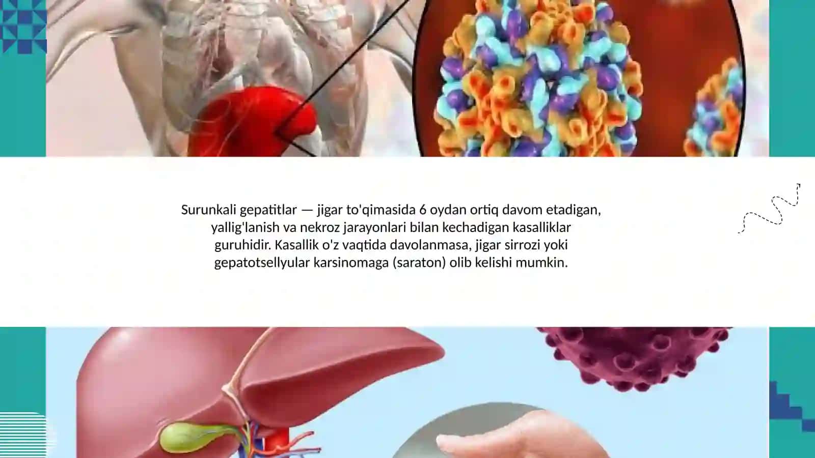 Surunkali gepatitlar 3