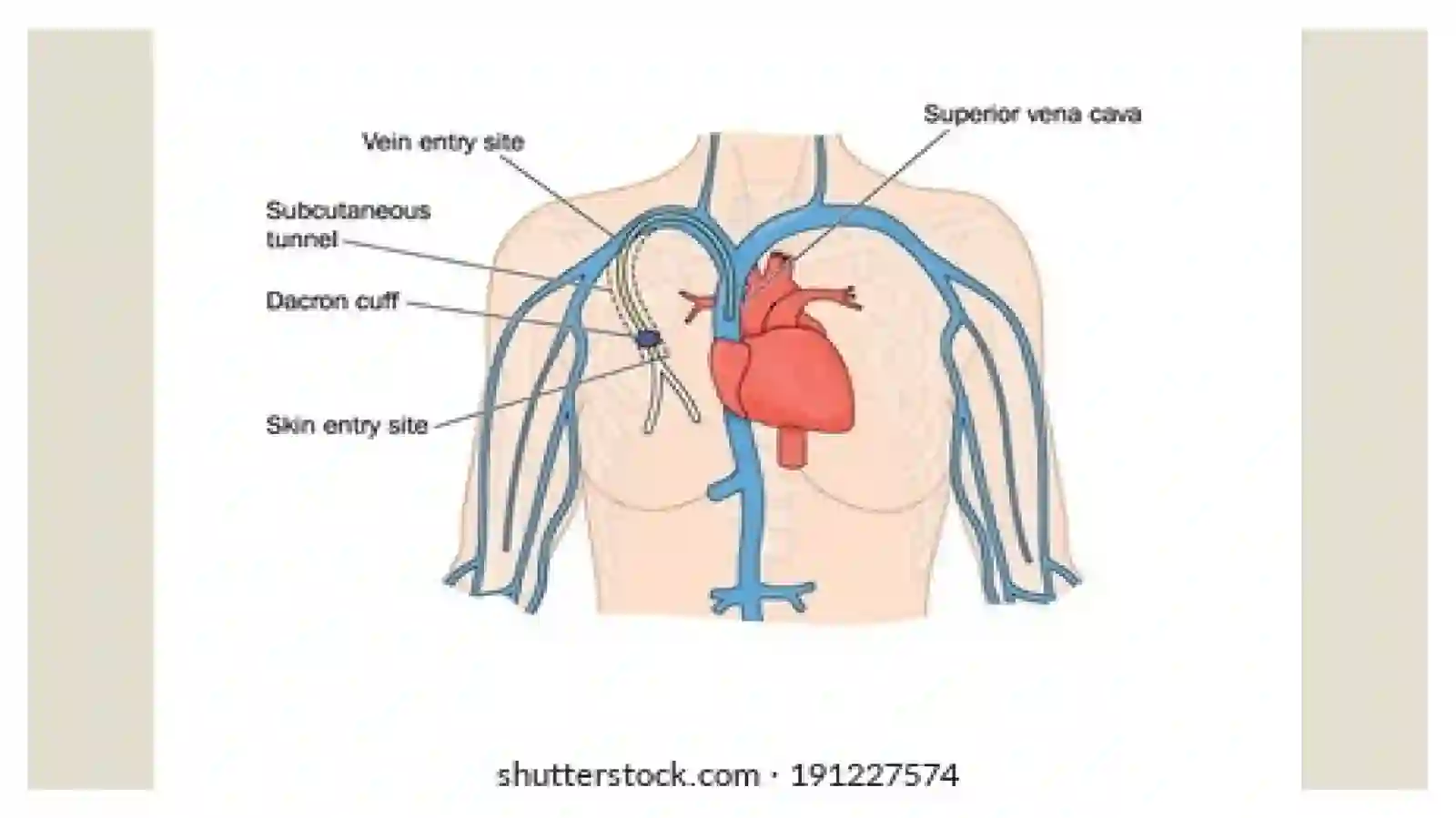 Venalar 3
