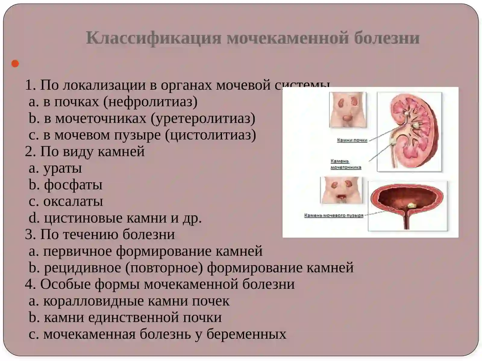 Мочекаменная болезнь 3