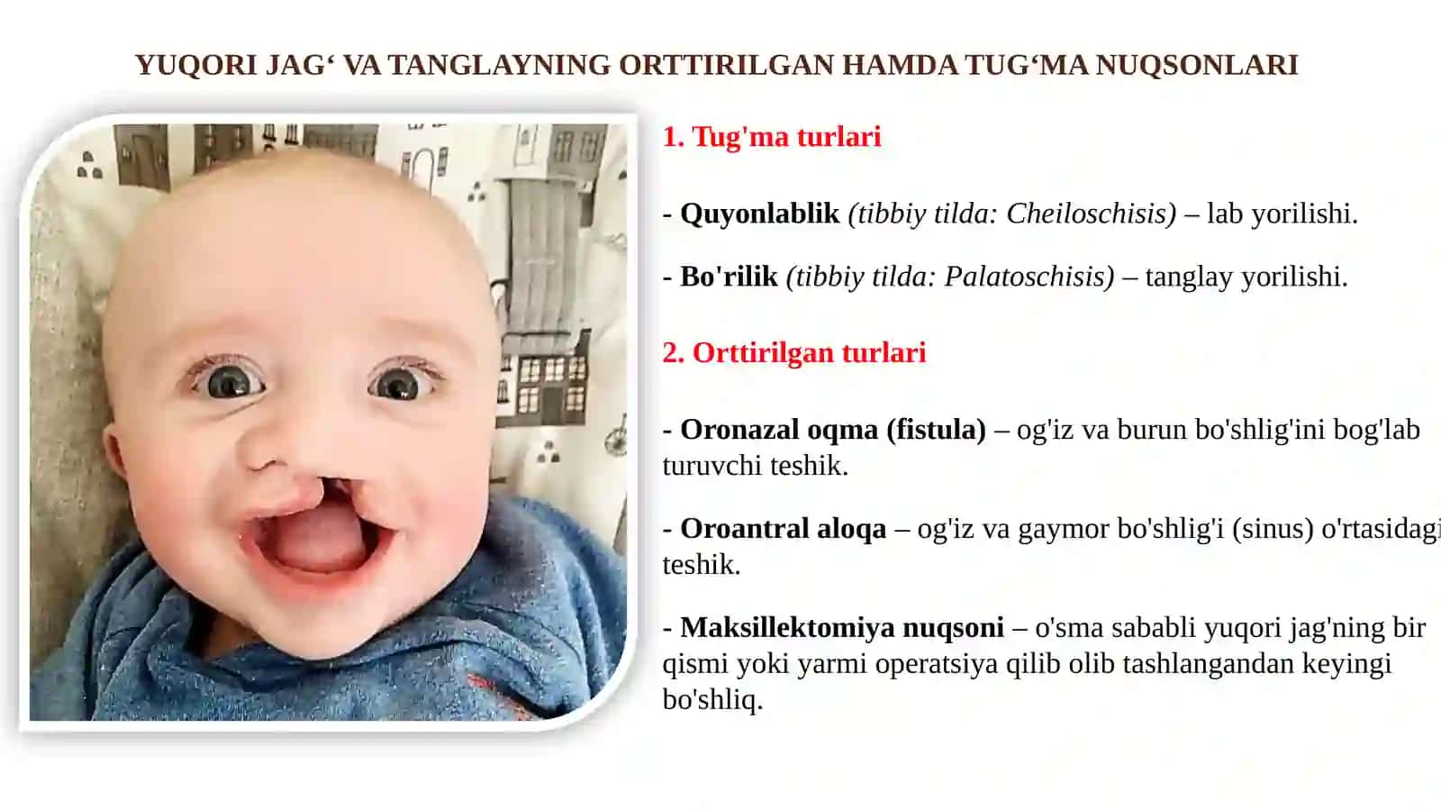 Yuqori Jag' va Tanglayning Ortirilgan Hamda Tug'ma Nuqsonlarini Ortopedik Davolash 3
