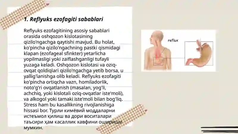 Reflyuks ezofagit 3