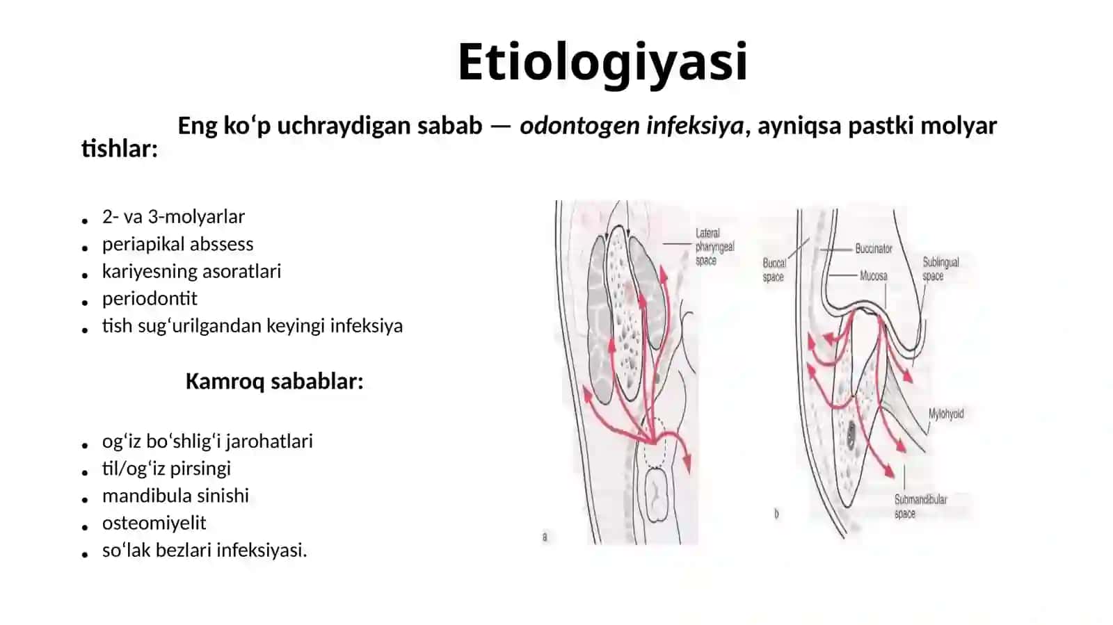 Og’iz tubi flegmonasi 3