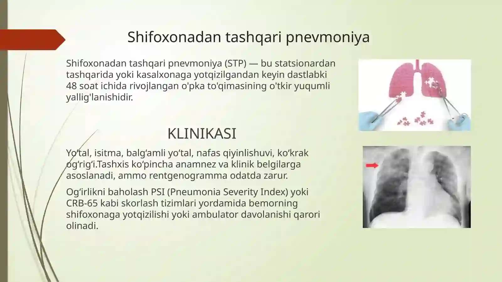 Infeksion tabiatga ega kasalliklarni ratsional davolashga klinik farmakologik yondashuv 3