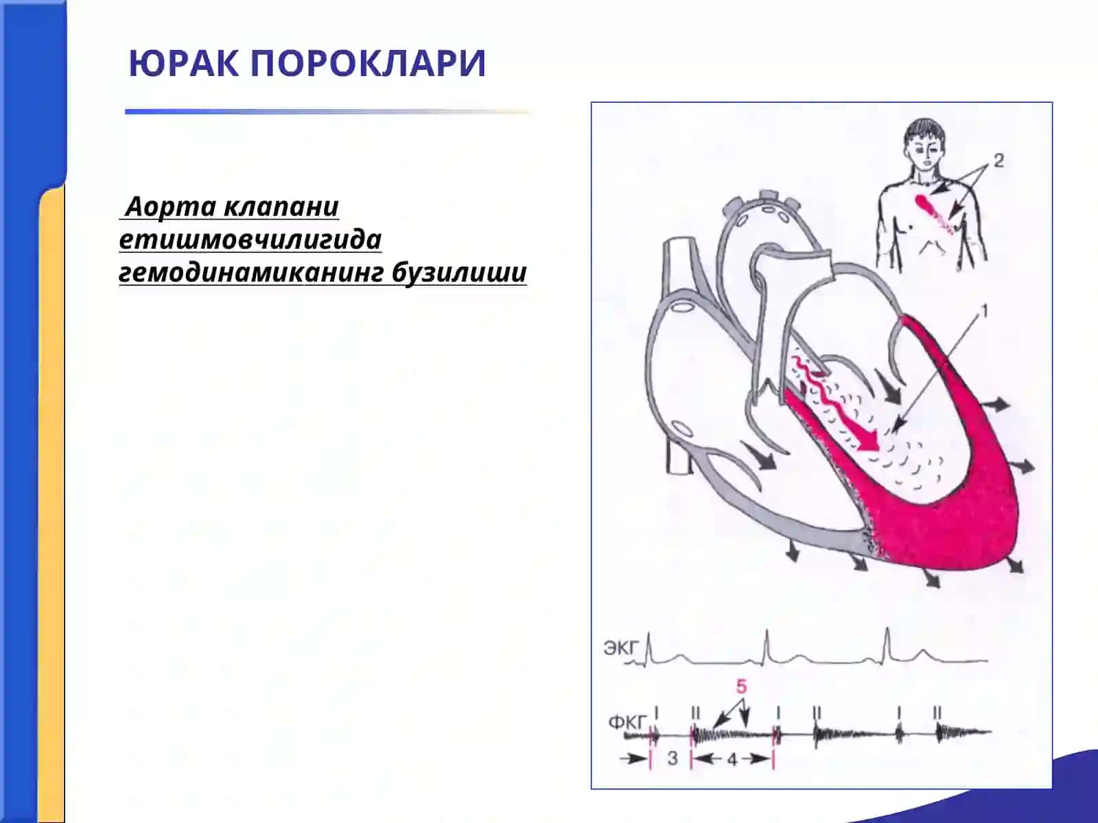 АОРТА КЛАПАНИНИНГ ЕТИШМОВЧИЛИГИ 3