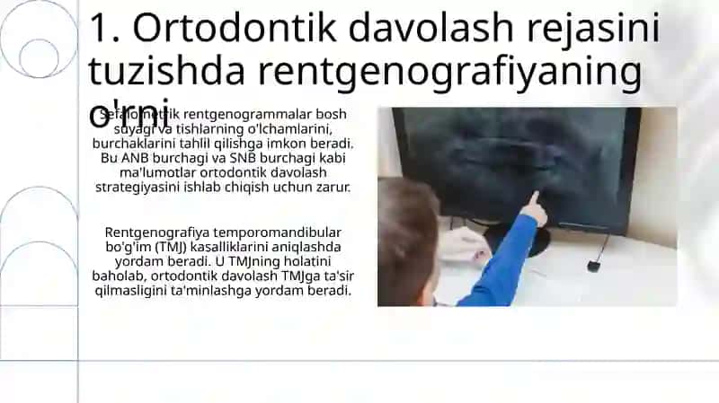 Ortodontik bemorlarni rentgenologik tekshirish usullarini o‘rganish 3