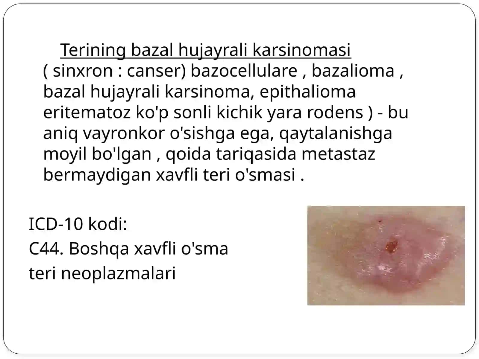 terining bazal hujayrali karsinomasi, melanoma va teri o'smasi mavzulari 3