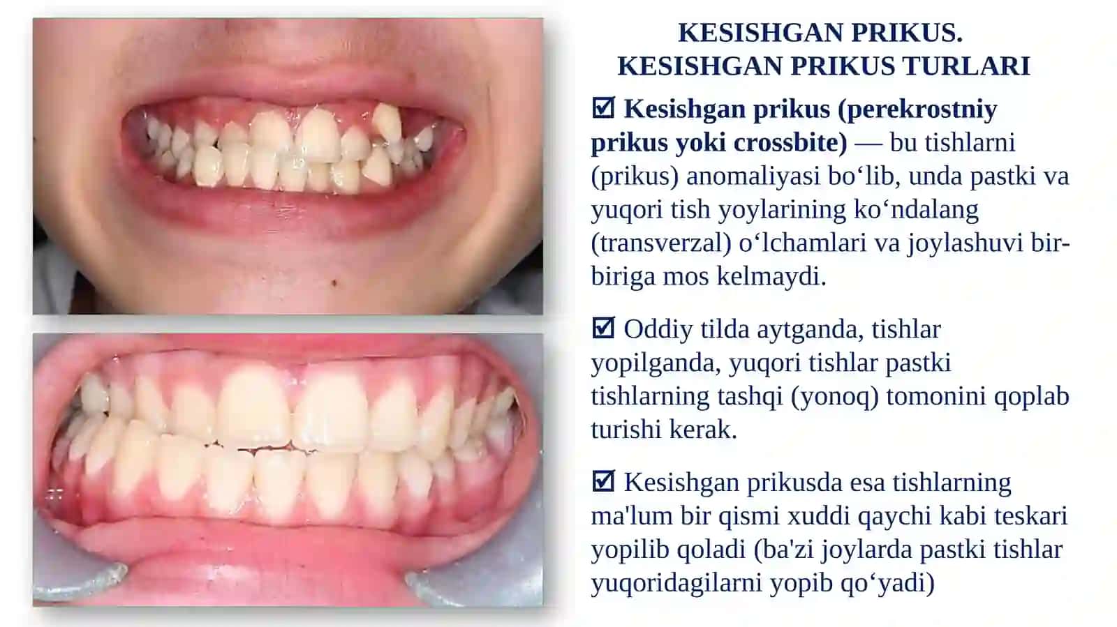 KESISHGAN PRIKUS 3