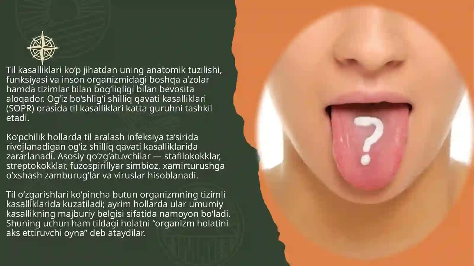 Til anomaliyalari: etiologiyasi, tashxis, davolash va dispanserizatsiya. 3