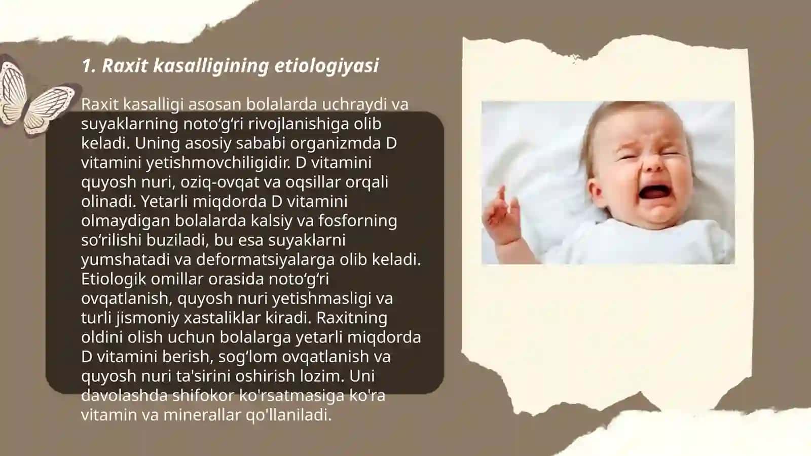 Bolalarda raxit. Etiopatogenezi, klinikasi, tekshirish ususllari, davolash, profilaktikasi 3