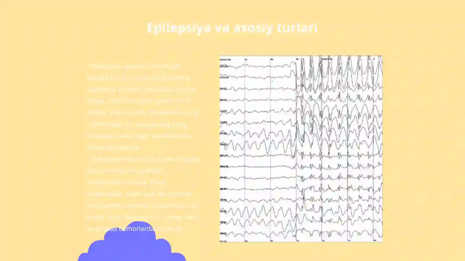 Epileptik forma sindromlari buzilishlari 3