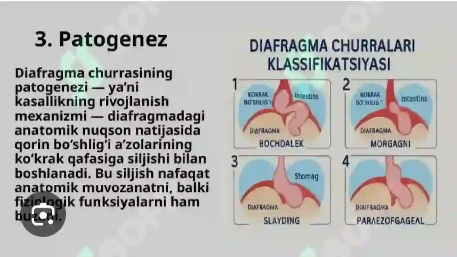 Diafragma jarohatlari 3