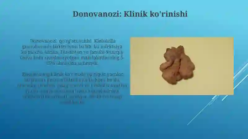 Venerik limfogranulema 3