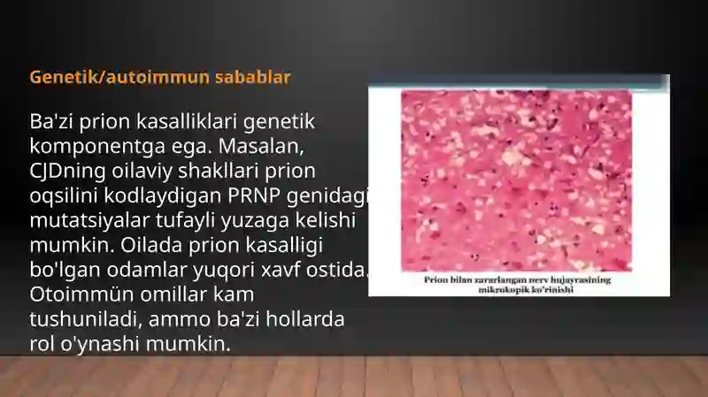 Prion kasalligi 3