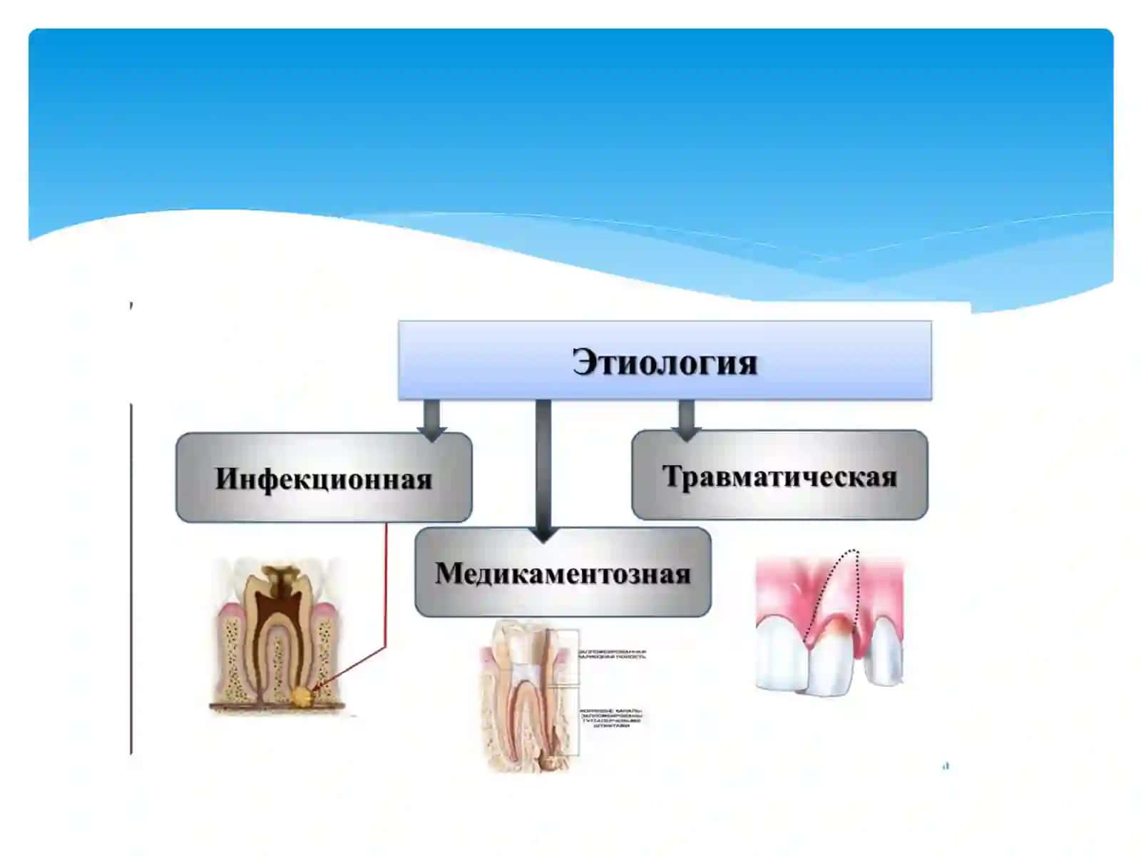Хронические формы периодонтитов классификация клиника,диагностика 3
