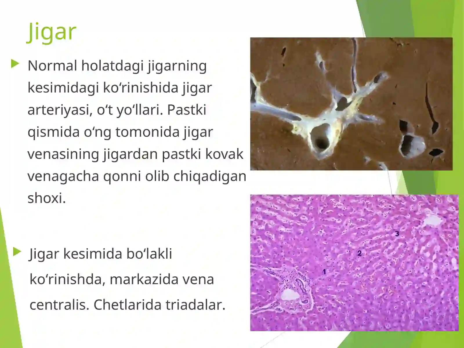 Jigar kasalliklari 3
