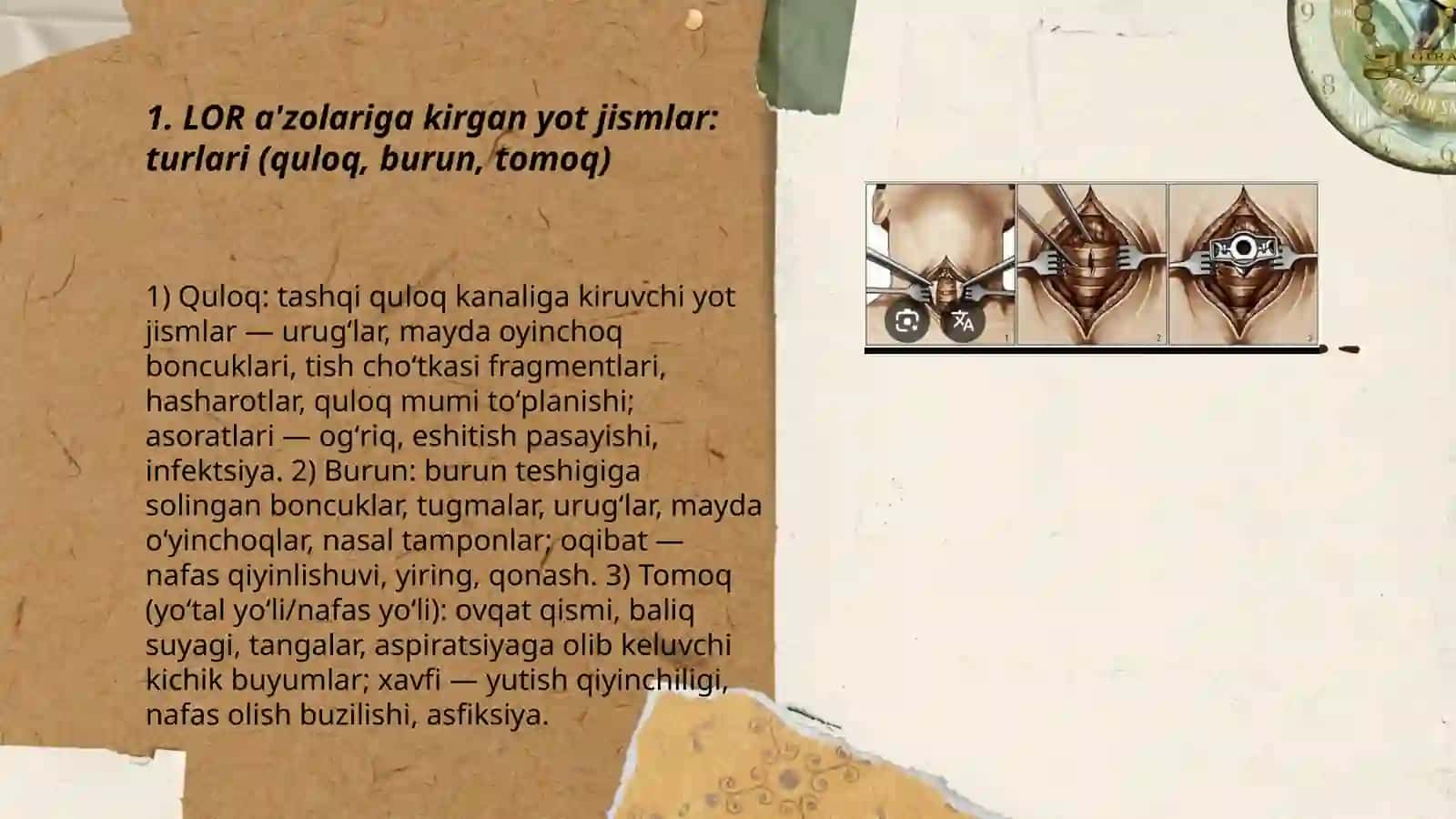 Loʻr aʼzolarining yot jismlari 3