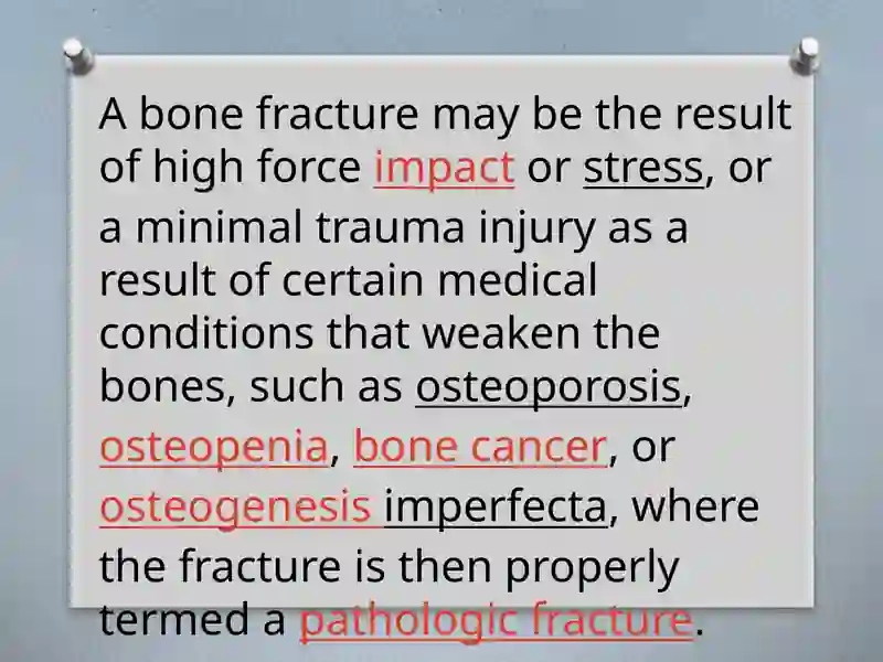 Bone fracture 3