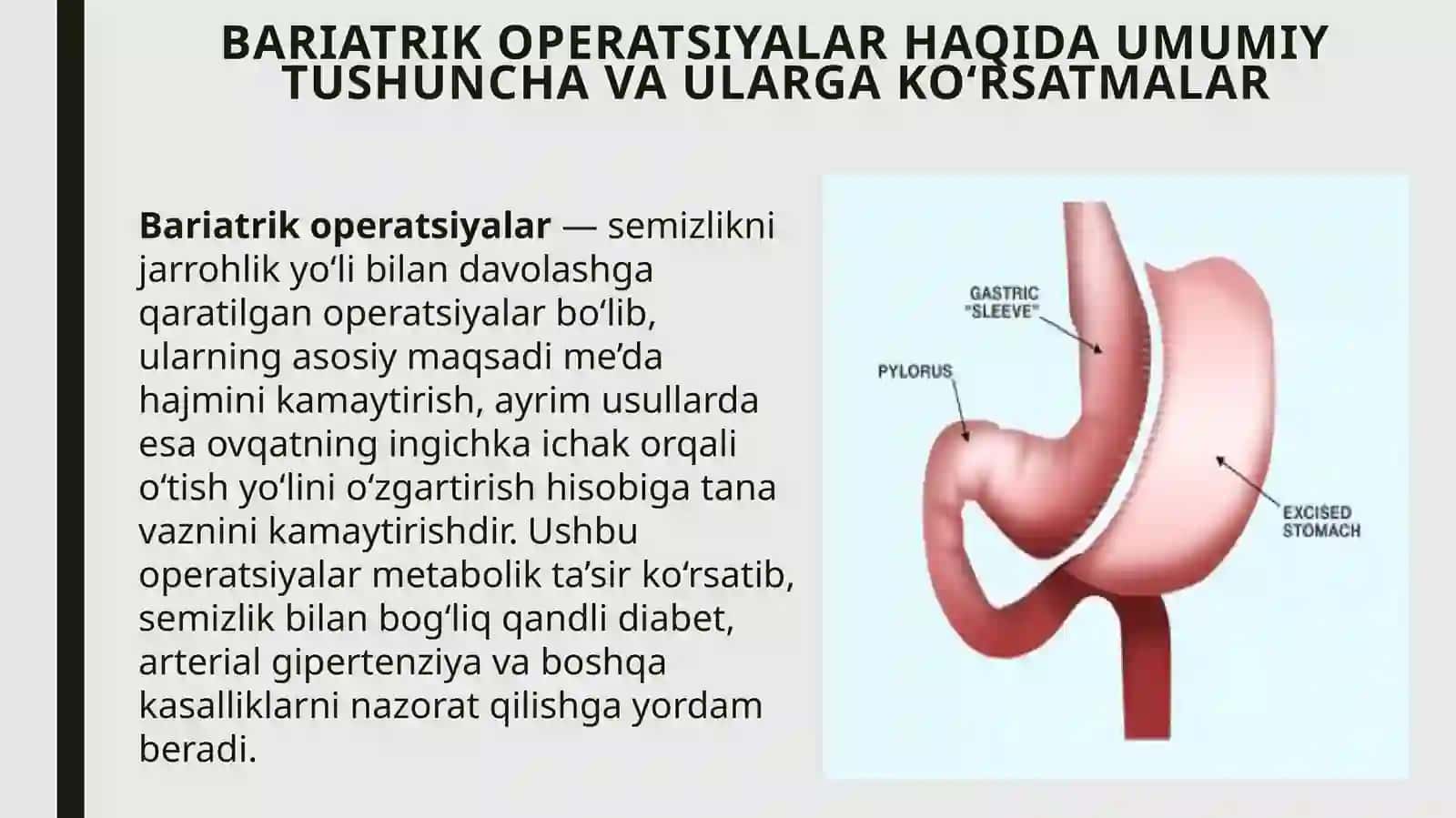 Bariatrik operatsiyalar 3