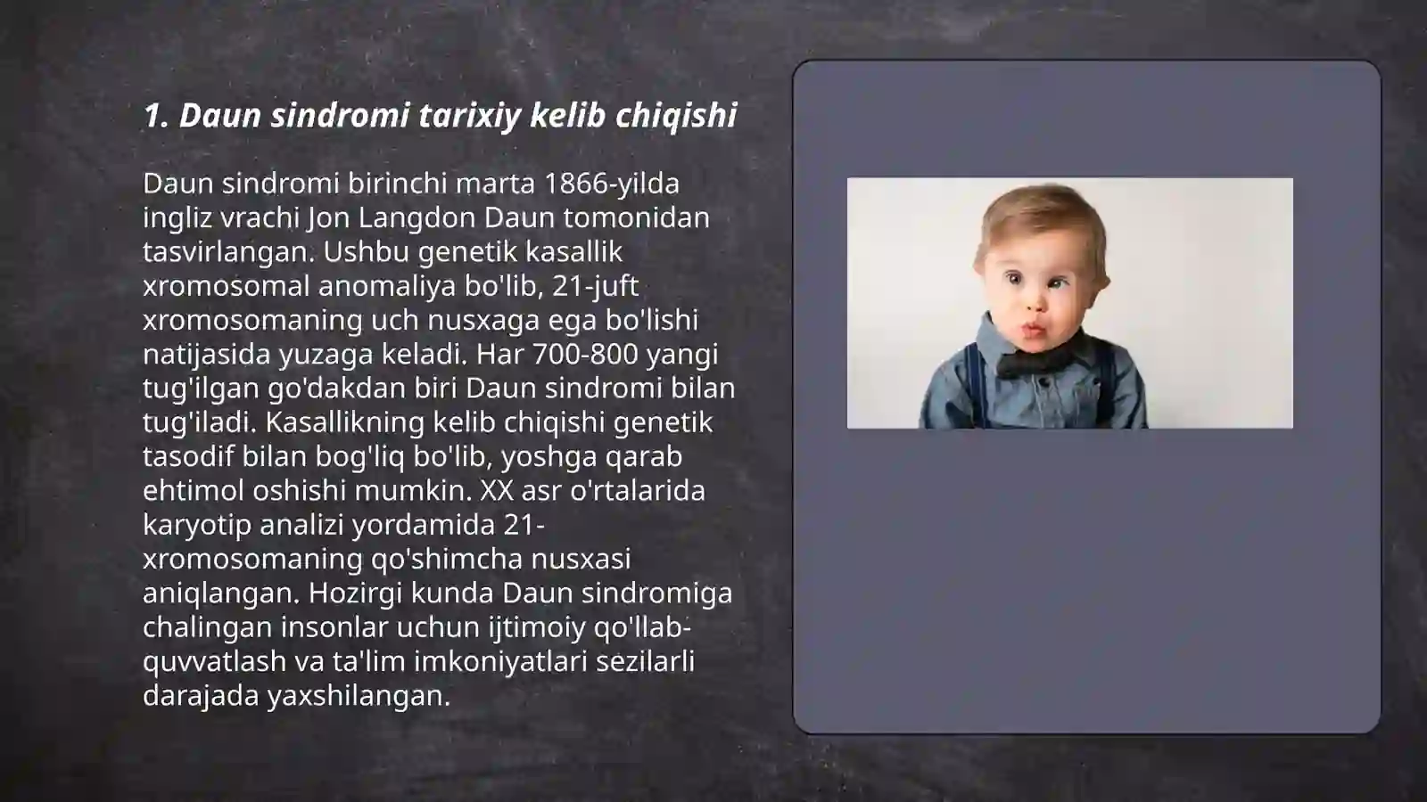 Daun sindromi 3