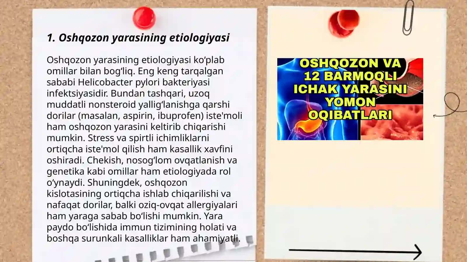 Oshqozon yarasi kasalligi etiologiyasi va patogenezidagi zamonaviy aspektlar 3