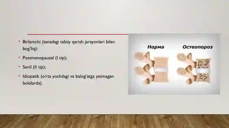 Osteoporoz kasalliklari 3