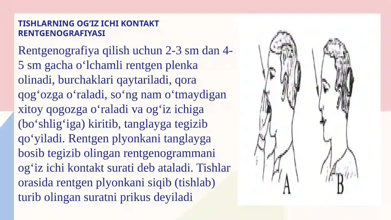 TISH VA JAG‘LARNI RENTGENOLOGIK TEKSHIRISH USULLARI 3