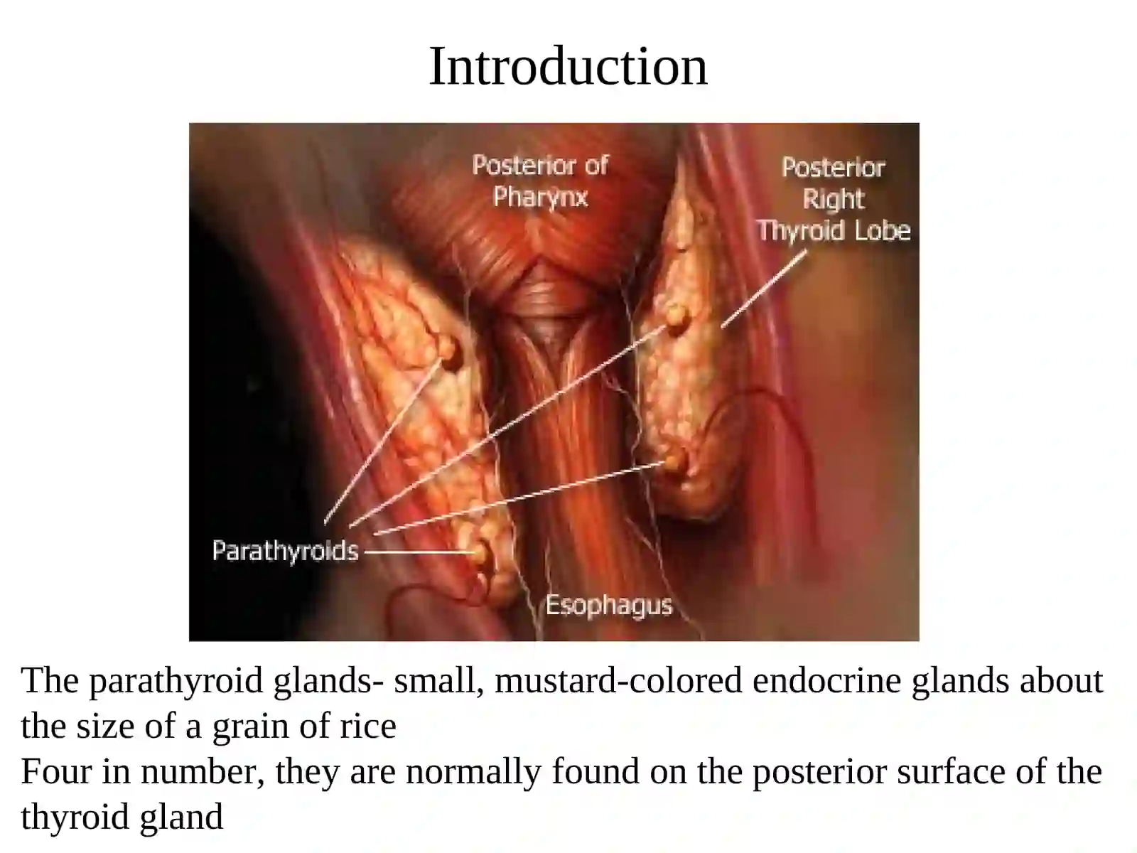Parathyroid Disorders 3