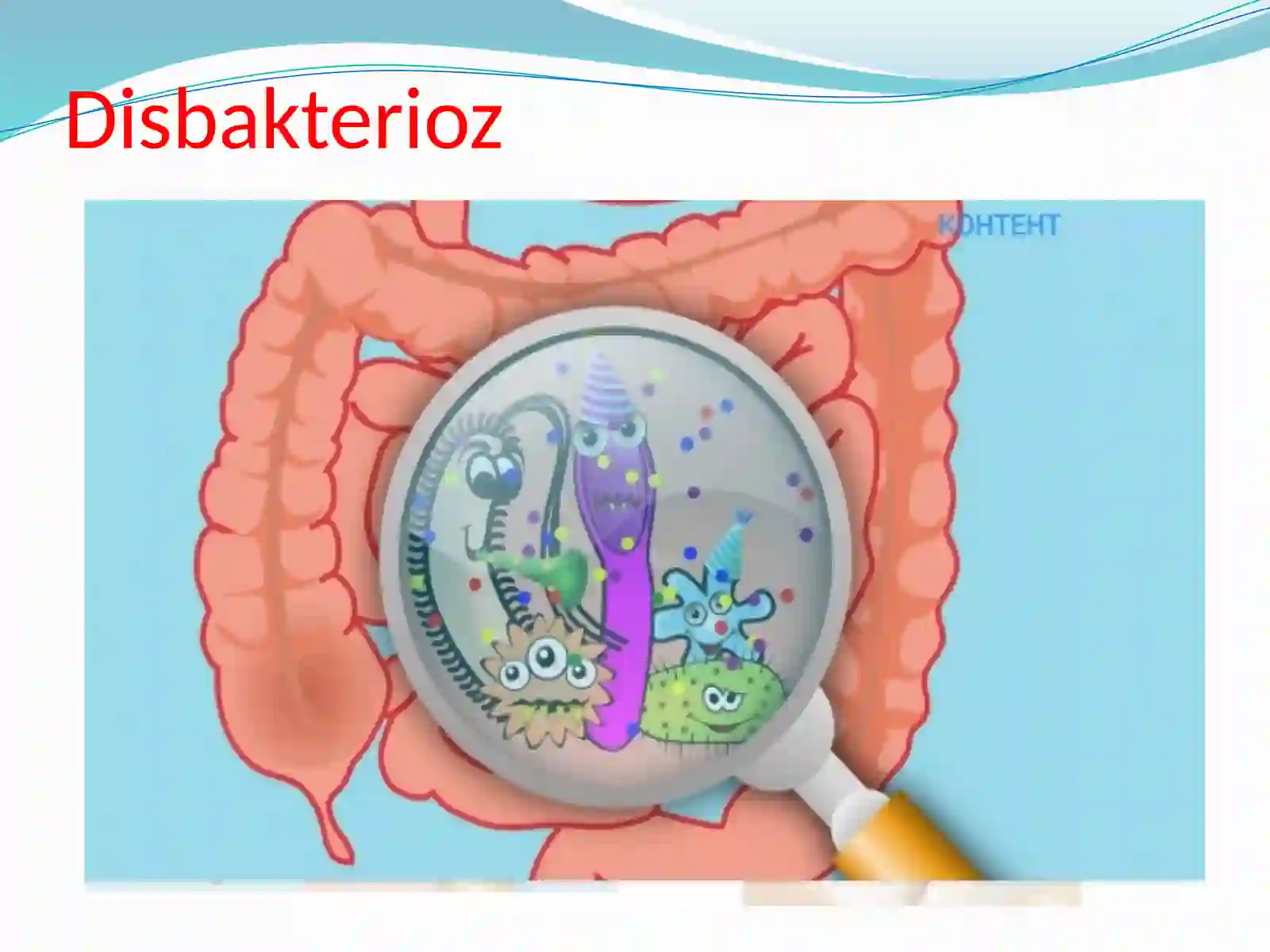 Disbakterioz 3