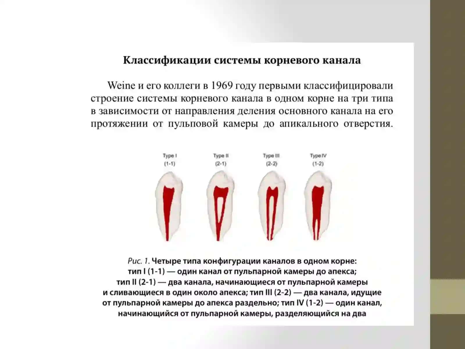 Топография анатомии полости зуба 3