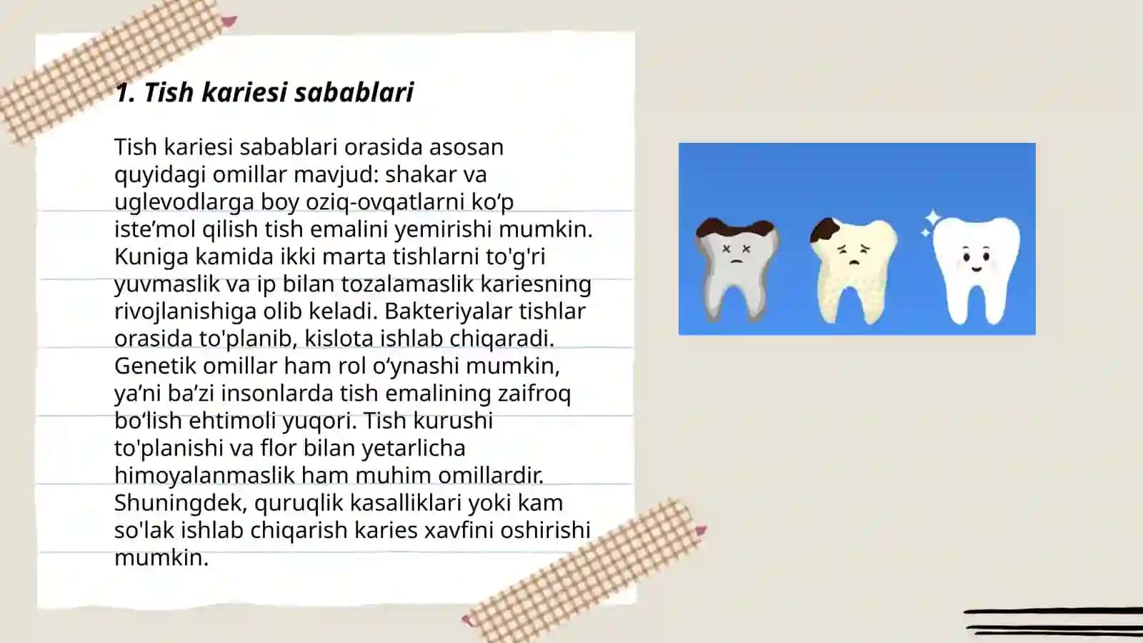 Tish kariesi turlari, davolash va oldini olish 3