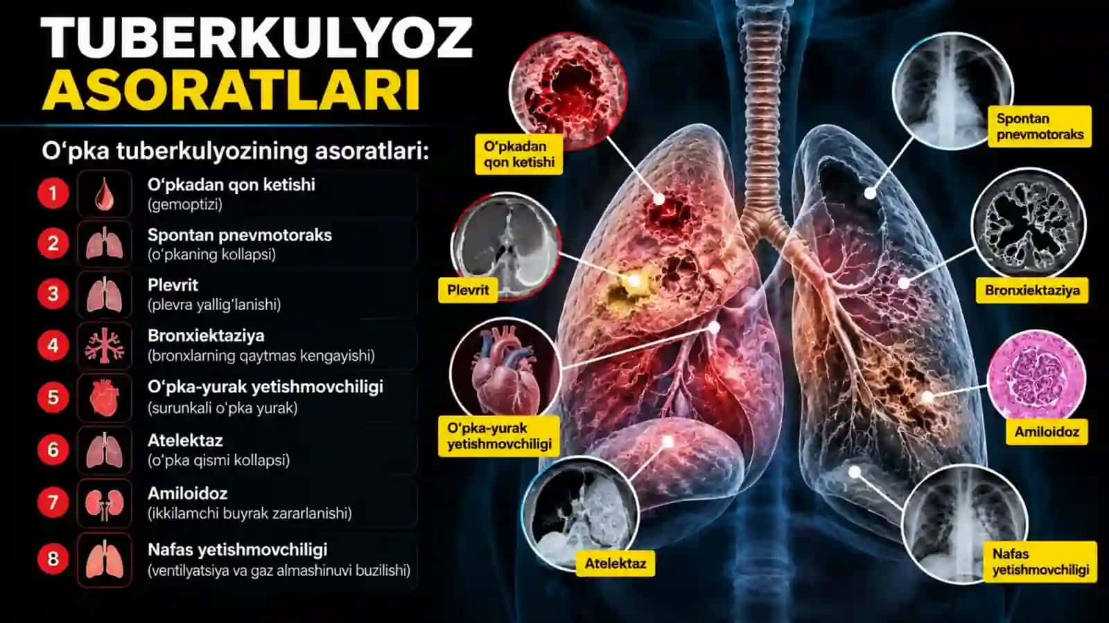 Oʻpka tuberkulyozi asoratlari. Tuberkulyoz bilan kasallangan bemorlarda nafas yetishmovchiligi.pptx 3