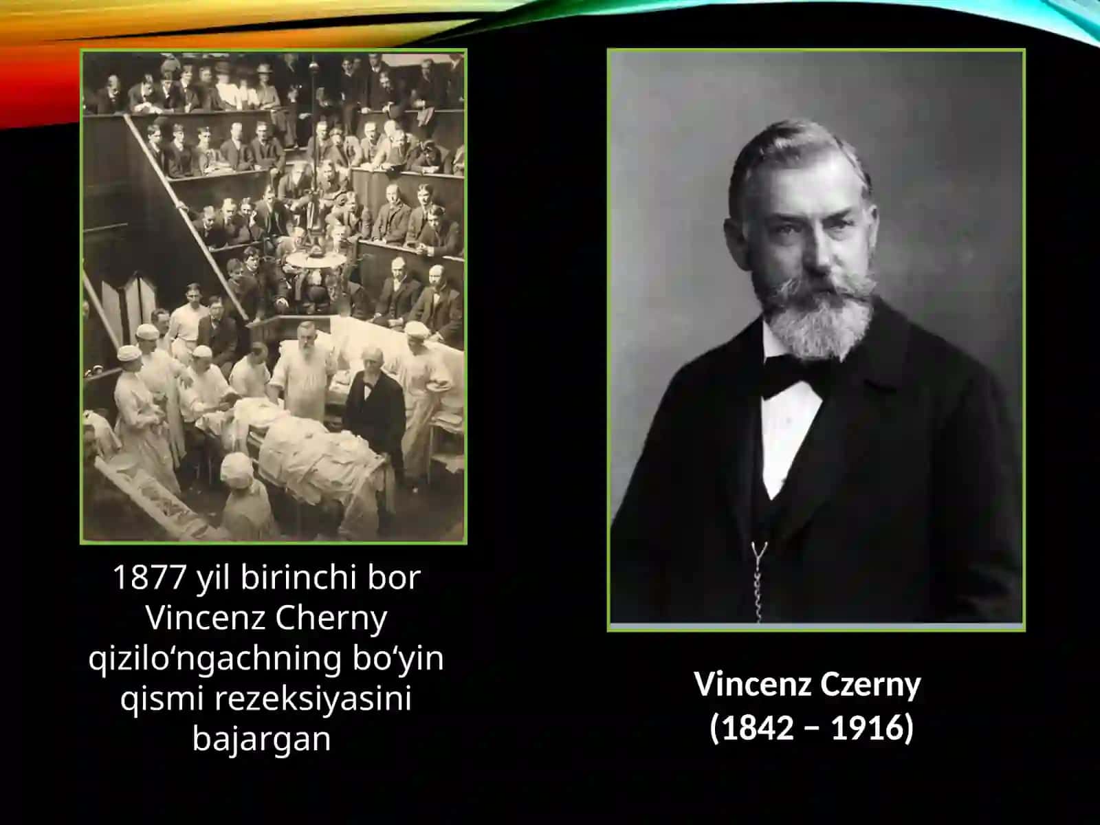 Qizilo’ngach kuyishivayot jism 3