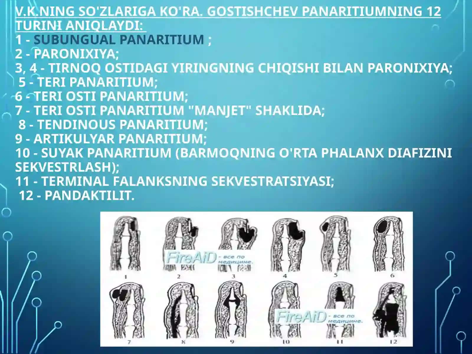 kaft  panaritium, flegmona etiologiyasi va patogenezi 3