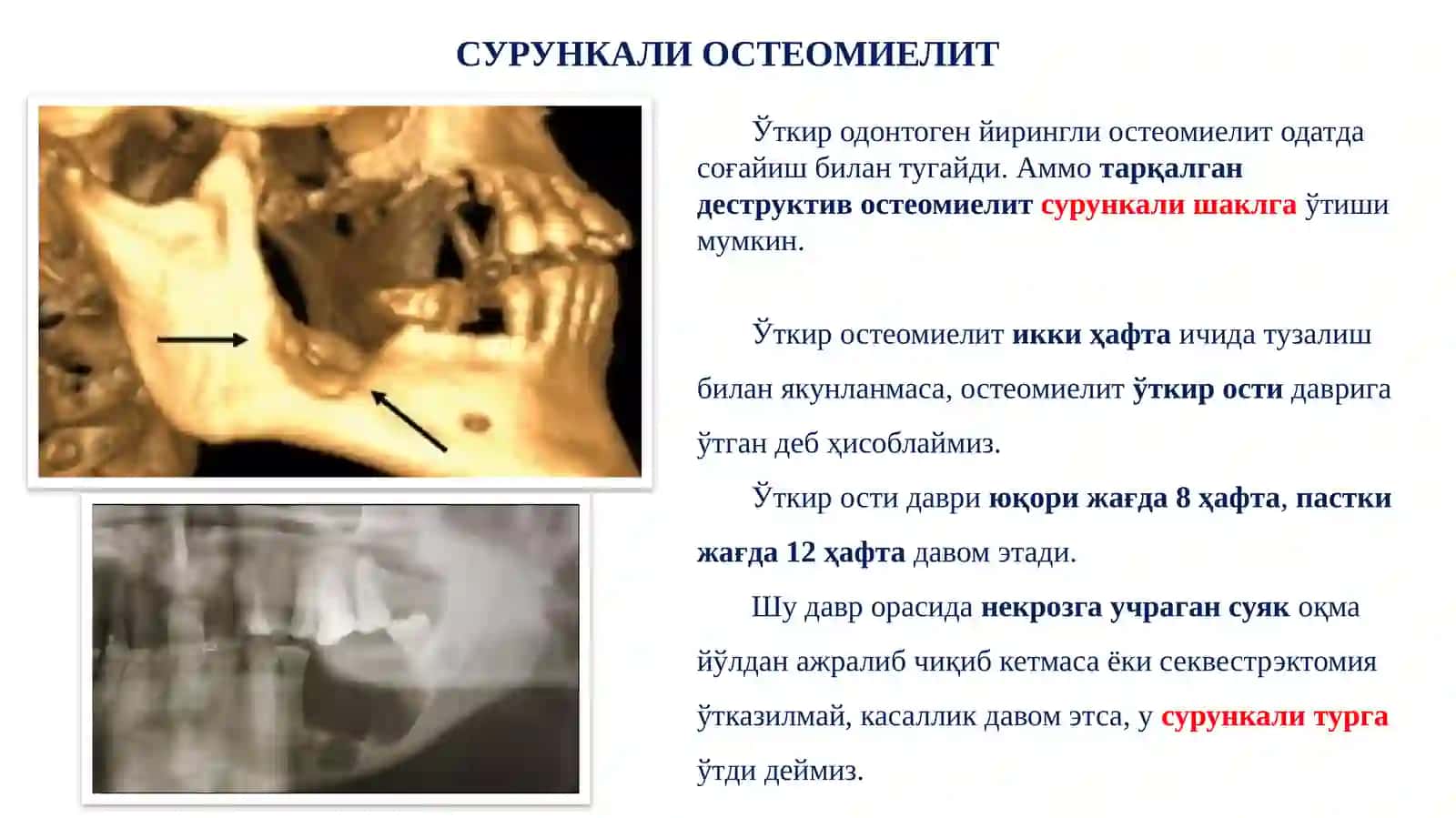 СУРУНКАЛИ ОСТЕОМИЕЛИТИДАН СЎНГ ЮЗАГА КЕЛАДИГАН АСОРАТЛАР 3