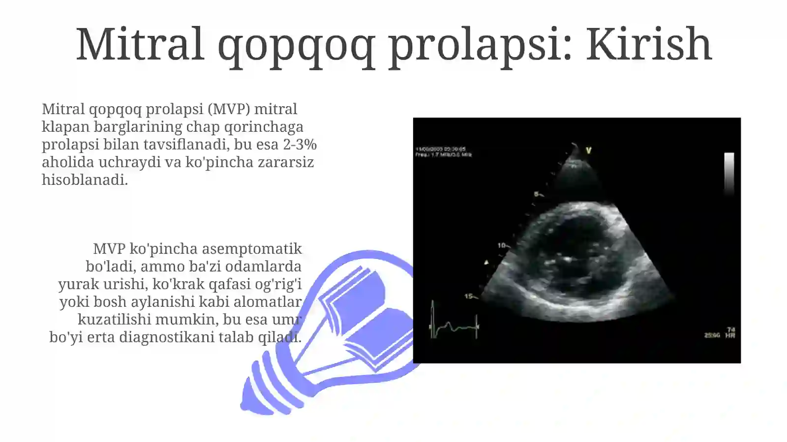 Mitral klapan prolapse 3