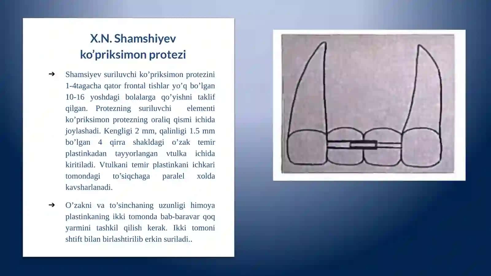 X.N.Shamshiyev ko’priksimon protezi. 3