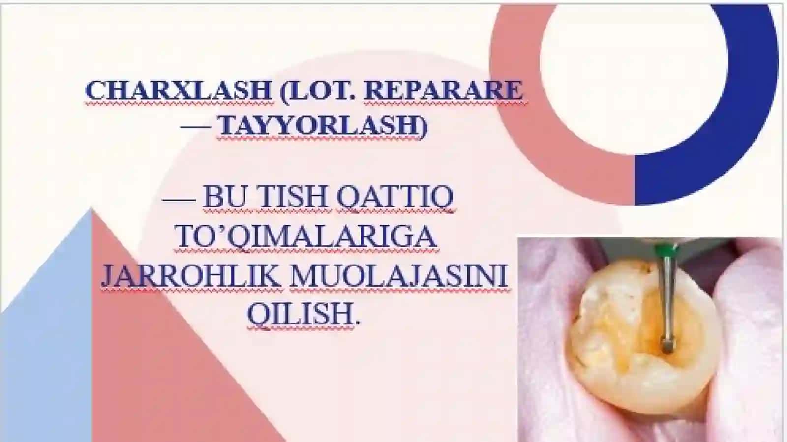 Preklinik restavratsion stomatologiya 3